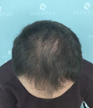 IMG_7867-rfe2ritjlrzgh8kd6u26pnb1nrjemab0nrswk7ojos