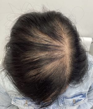 IMG_7872-rfe2rzqn0smma7vsg1dgyj1ccp80gu66q3jn76zgks