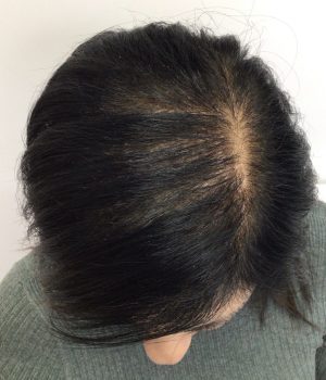 IMG_7873-rfe2rzqn0smma7vsg1dgyj1ccp80gu66q3jn76zgks